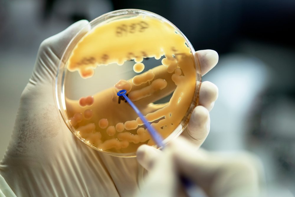 Если мы можем выращивать бактерии в лаборатории, почему мы знаем только об 1% из них?