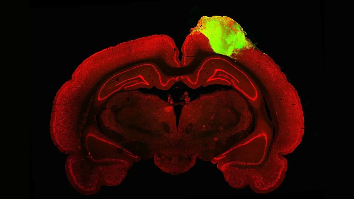 Исследователи восстановили повреждения мозга у крыс путем имплантации органоидов человеческого мозга