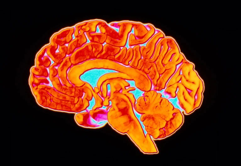 Новое исследование показало, что место проживания может влиять на здоровье вашего мозга