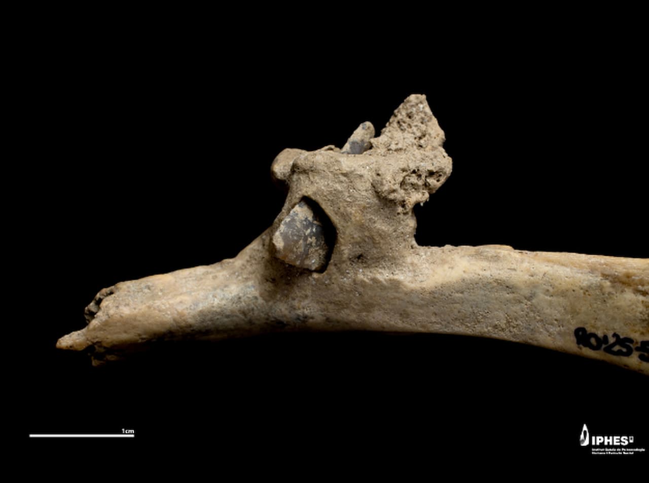Кремнёвый наконечник стрелы, застрявший в человеческом ребре: выстрел в спину более 4000 лет назад