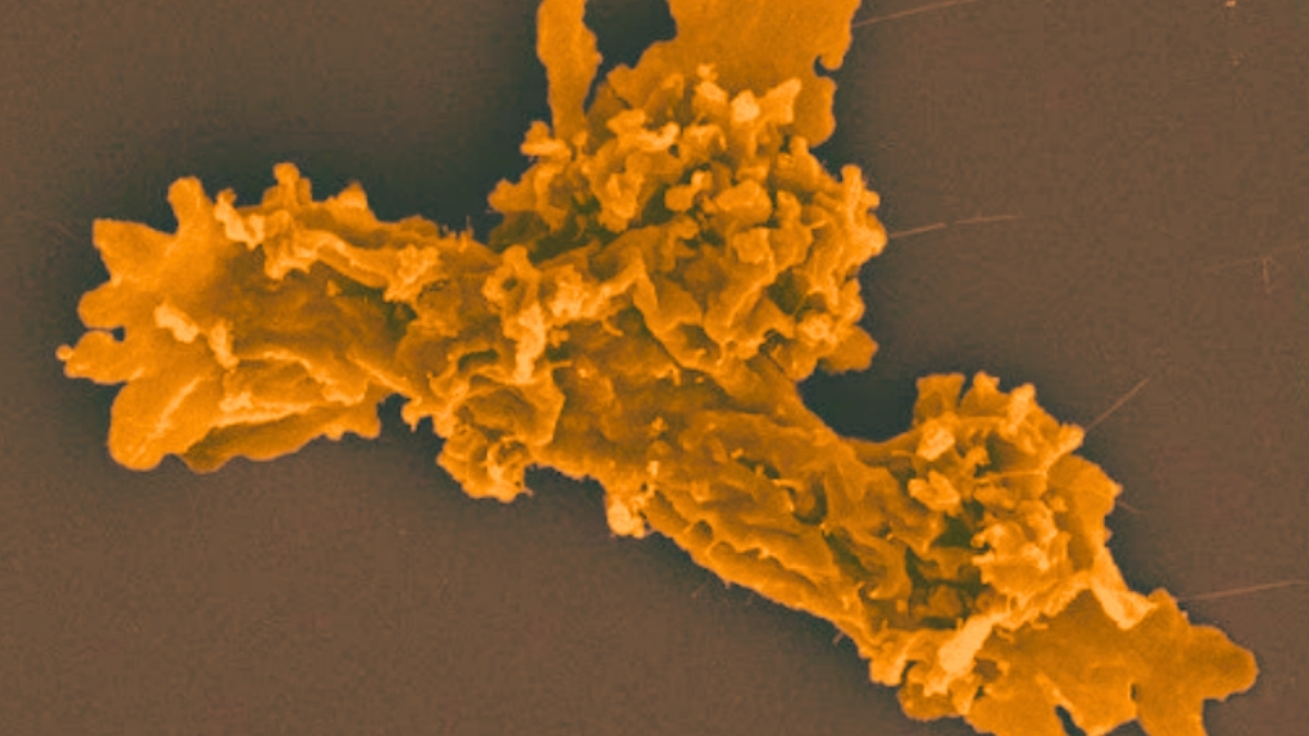 Жизнь в кипятке: открыта амеба, меняющая представления о пределах выживания