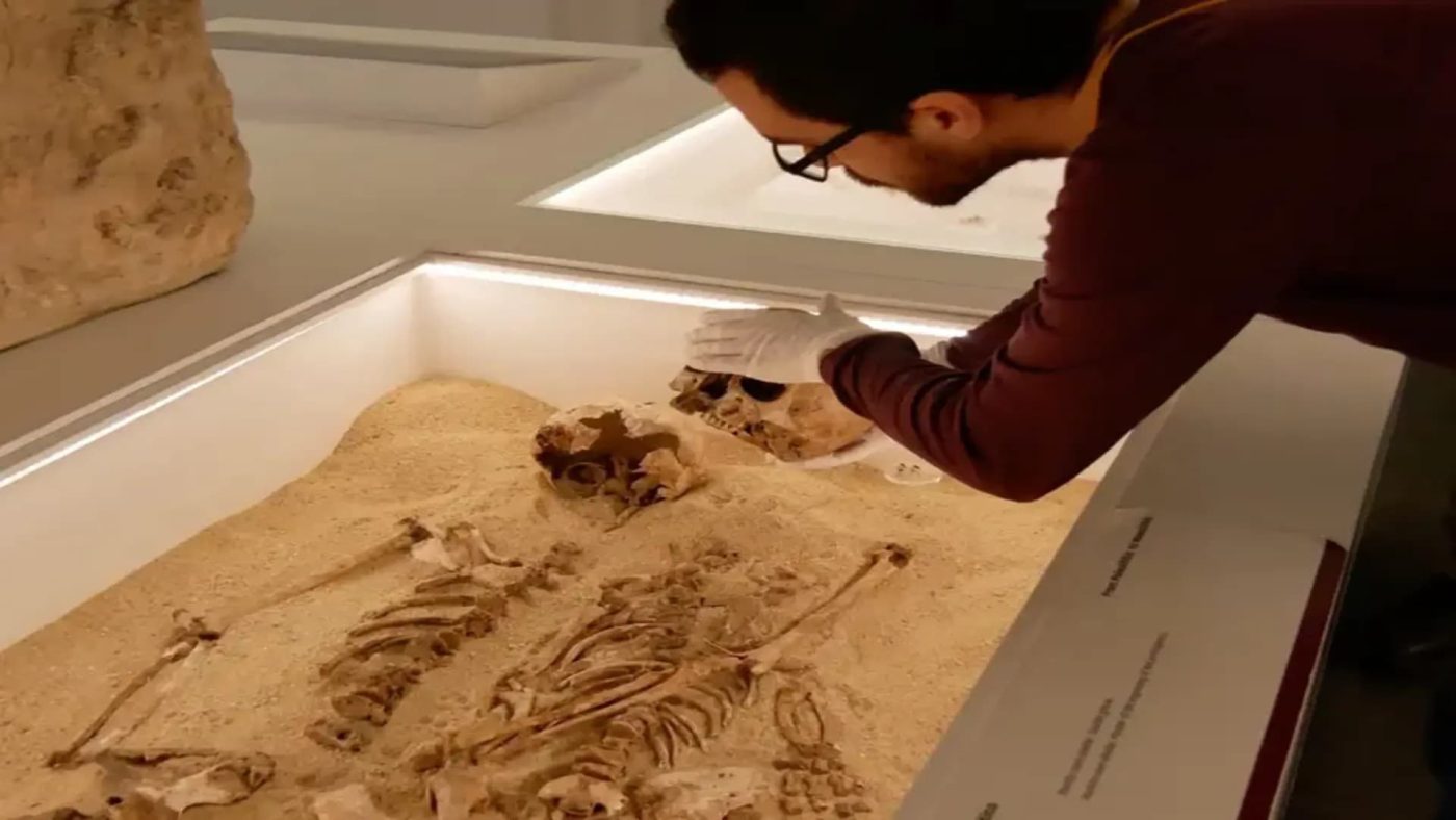 Ученые подтвердили самый древний случай редкого генетического заболевания в истории человечества