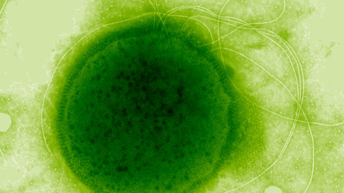 Ученые раскрыли секрет невероятной радиационной устойчивости микроба из гидротермальных источников